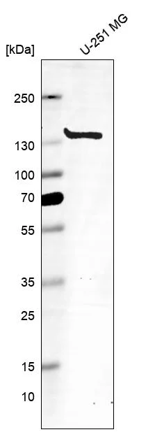 Western blot - Anti-MSH3 Antibody [CL14064] (AB327152)