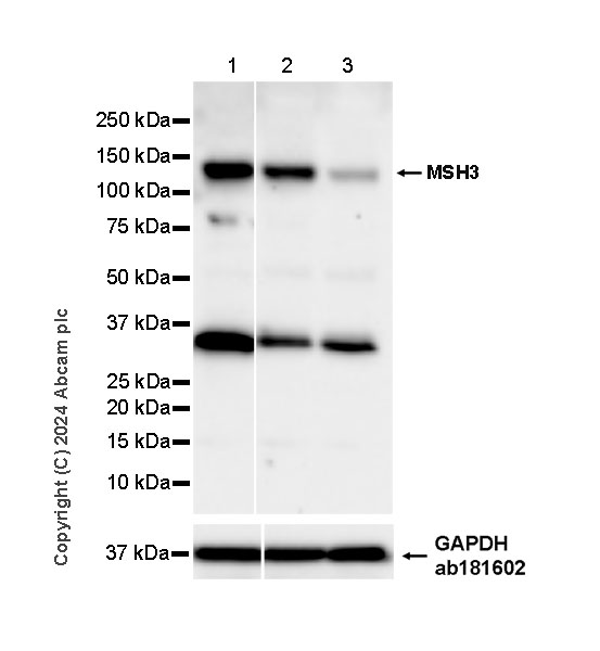 Western blot - Anti-MSH3 antibody [EPR29050-69] (AB324225), expandable thumbnail