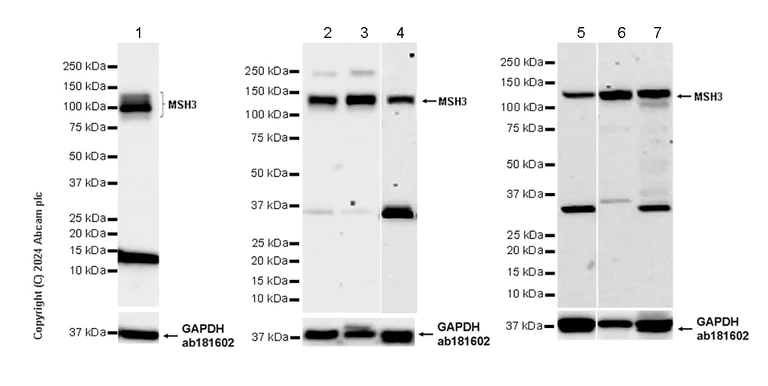 Western blot - Anti-MSH3 antibody [EPR29050-69] (AB324225)