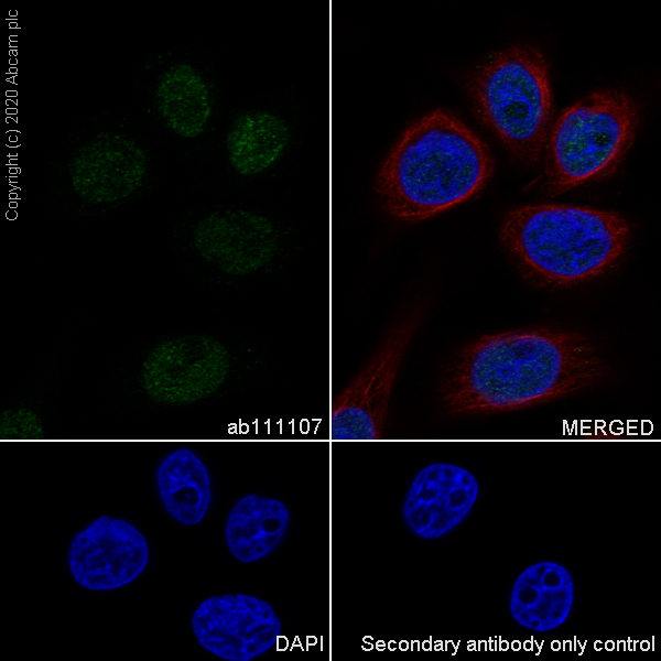 Immunocytochemistry/ Immunofluorescence - Anti-MSH3 antibody [EPR4334(2)] (AB111107), expandable thumbnail