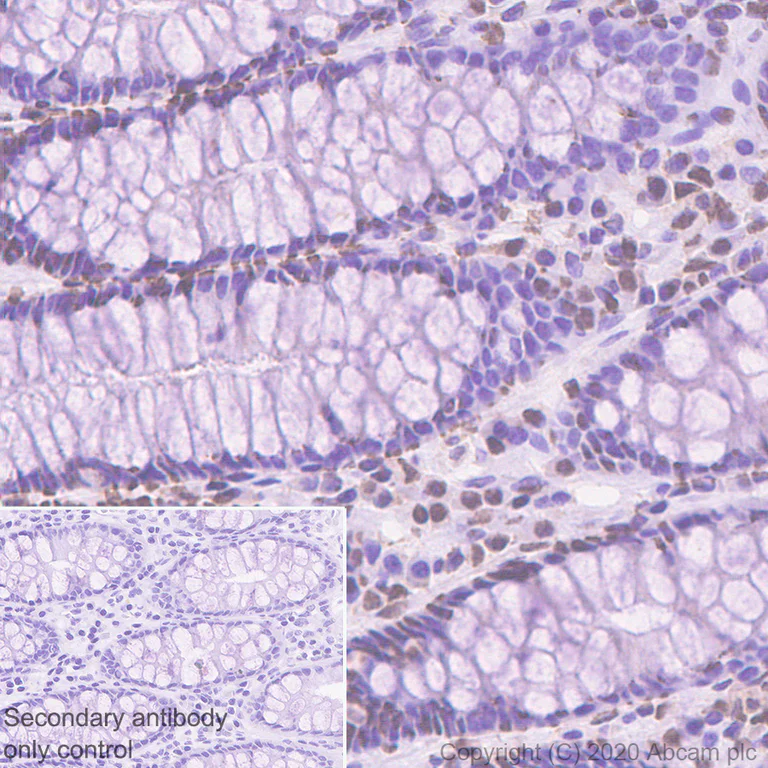 Immunohistochemistry (Formalin/PFA-fixed paraffin-embedded sections) - Anti-MSH3 antibody [EPR4334(2)] (AB111107)