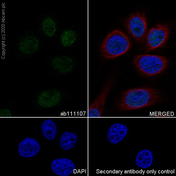 Immunocytochemistry/ Immunofluorescence - Anti-MSH3 antibody [EPR4334(2)] - BSA and Azide free (AB226079)