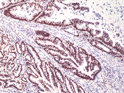 Immunohistochemistry (Formalin/PFA-fixed paraffin-embedded sections) - Anti-MSH3 antibody [RM405] (AB275928)