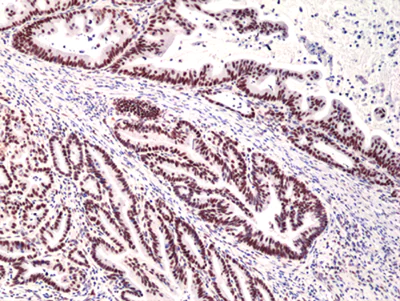 Immunohistochemistry (Formalin/PFA-fixed paraffin-embedded sections) - Anti-MSH3 antibody [RM405] (AB275928)