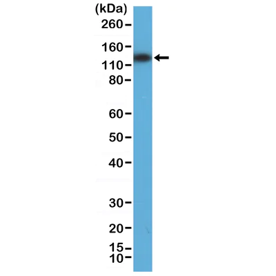 Western blot - Anti-MSH3 antibody [RM405] (AB275928)