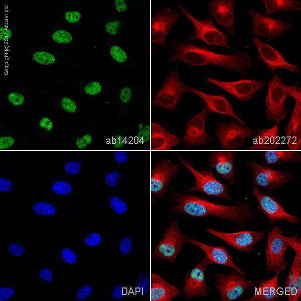 Immunocytochemistry/ Immunofluorescence - Anti-MSH6 antibody [44] (AB14204)