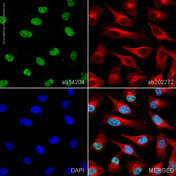 Immunocytochemistry/ Immunofluorescence - Anti-MSH6 antibody [44] (AB14204)
