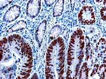 Immunohistochemistry (Formalin/PFA-fixed paraffin-embedded sections) - Anti-MSH6 antibody [44] (AB14204)