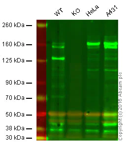 Western blot - Anti-MSH6 antibody [44] (AB14204)