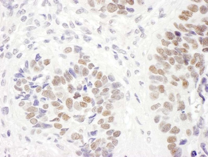 Immunohistochemistry (Formalin/PFA-fixed paraffin-embedded sections) - Anti-MSH6 antibody (AB10340), expandable thumbnail