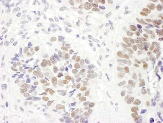 Immunohistochemistry (Formalin/PFA-fixed paraffin-embedded sections) - Anti-MSH6 antibody (AB10340)