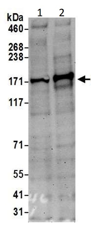 Western blot - Anti-MSH6 antibody (AB10340), expandable thumbnail
