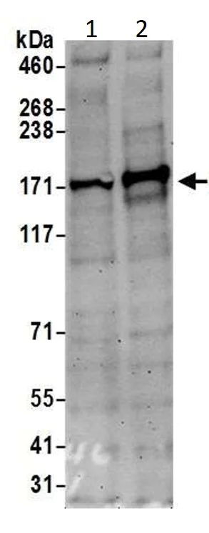 Western blot - Anti-MSH6 antibody (AB10340)