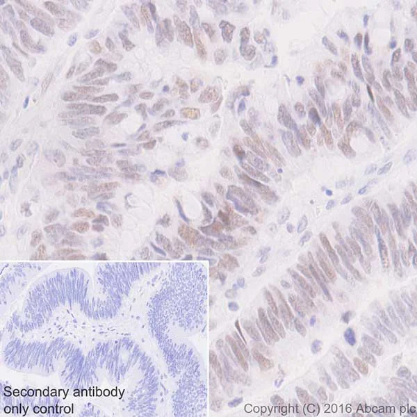 Immunohistochemistry (Formalin/PFA-fixed paraffin-embedded sections) - Anti-MSH6 antibody [EPR20316] (AB208940)