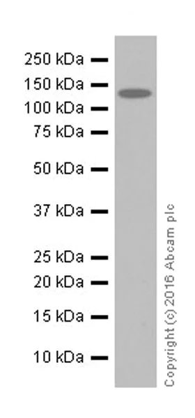 Western blot - Anti-MSH6 antibody [EPR20316] (AB208940)