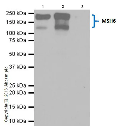 Immunoprecipitation - Anti-MSH6 antibody [EPR20316] - BSA and Azide free (AB251498)