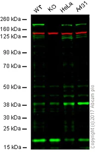 Western blot - Anti-MSH6 antibody [EPR20316] - BSA and Azide free (AB251498)