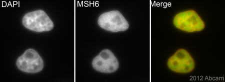 Immunocytochemistry/ Immunofluorescence - Anti-MSH6 antibody [EPR3945] (ab92471), expandable thumbnail