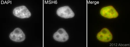 Immunocytochemistry/ Immunofluorescence - Anti-MSH6 antibody [EPR3945] (AB92471)