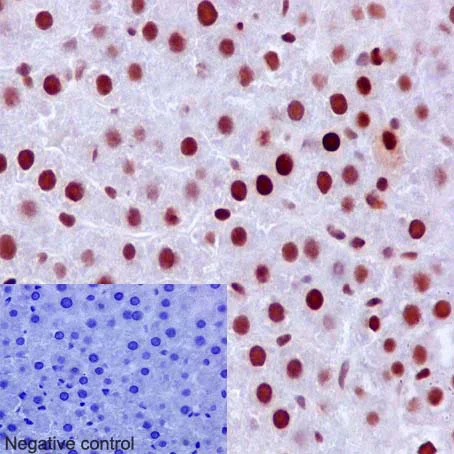 Immunohistochemistry (Formalin/PFA-fixed paraffin-embedded sections) - Anti-MSH6 antibody [EPR3945] (AB92471)