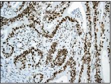 Immunohistochemistry (Formalin/PFA-fixed paraffin-embedded sections) - Anti-MSH6 antibody [EPR3945] (ab92471), expandable thumbnail