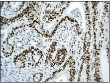 Immunohistochemistry (Formalin/PFA-fixed paraffin-embedded sections) - Anti-MSH6 antibody [EPR3945] (AB92471)