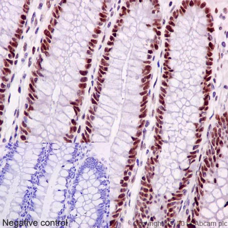 Immunohistochemistry (Formalin/PFA-fixed paraffin-embedded sections) - Anti-MSH6 antibody [EPR3945] (AB92471)