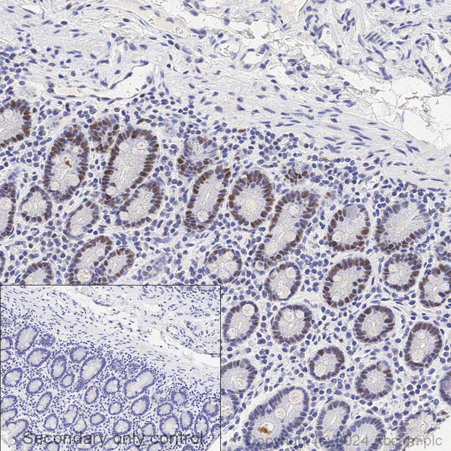 Immunohistochemistry - Anti-MSH6 antibody [EPR3945] (ab92471), expandable thumbnail