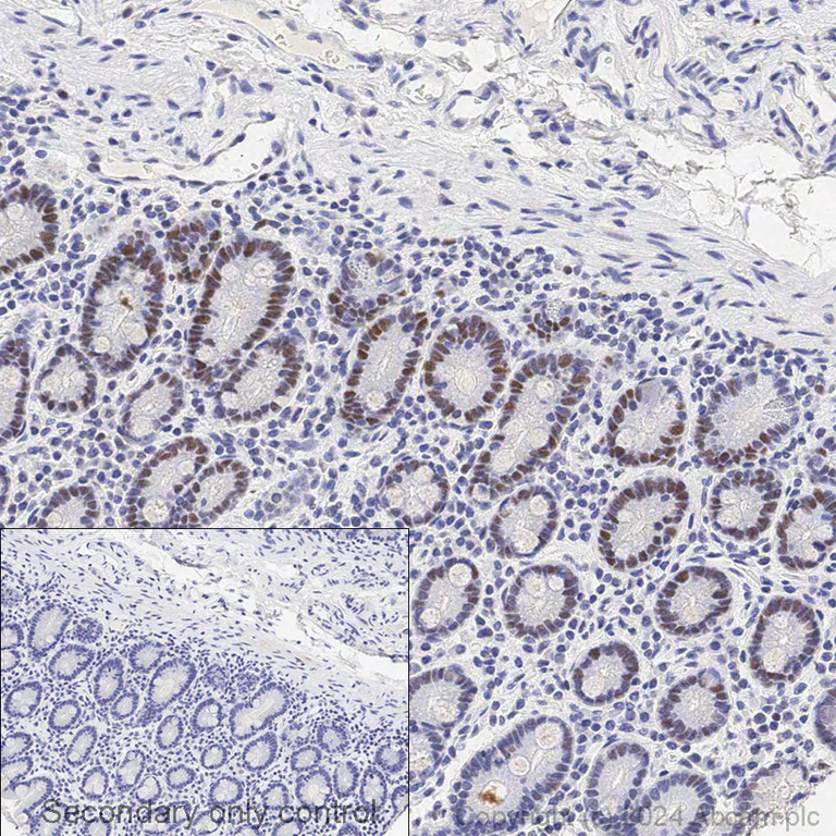Immunohistochemistry - Anti-MSH6 antibody [EPR3945] (AB92471)