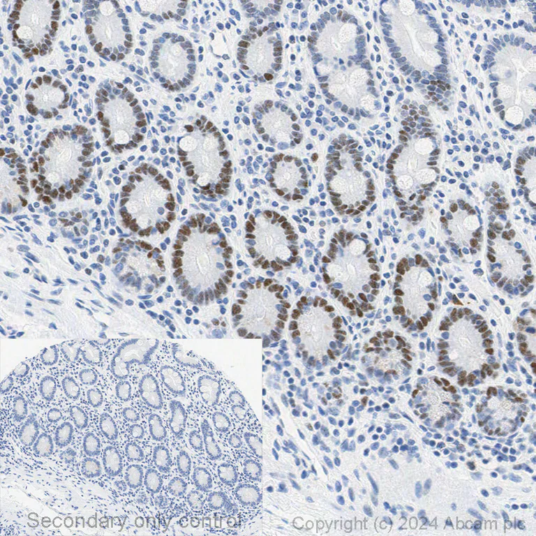 Immunohistochemistry - Anti-MSH6 antibody [EPR3945] (AB92471)