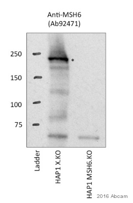 Western blot - Anti-MSH6 antibody [EPR3945] (ab92471), expandable thumbnail