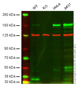 Western blot - Anti-MSH6 antibody [EPR3945] (AB92471)