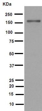 Western blot - Anti-MSH6 antibody [EPR3945] (ab92471), expandable thumbnail