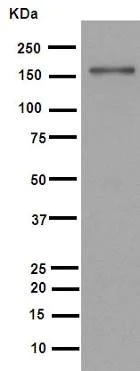 Western blot - Anti-MSH6 antibody [EPR3945] (AB92471)