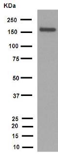 Western blot - Anti-MSH6 antibody [EPR3945] (ab92471), expandable thumbnail