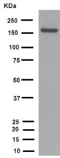 Western blot - Anti-MSH6 antibody [EPR3945] (AB92471)