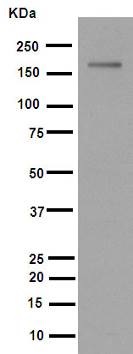 Western blot - Anti-MSH6 antibody [EPR3945] (ab92471), expandable thumbnail
