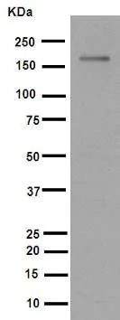 Western blot - Anti-MSH6 antibody [EPR3945] (AB92471)