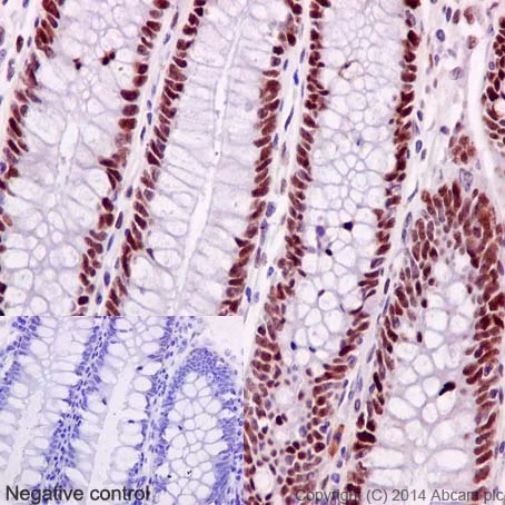 Immunohistochemistry (Formalin/PFA-fixed paraffin-embedded sections) - Anti-MSH6 antibody [EPR3945] - BSA and Azide free (AB214454)