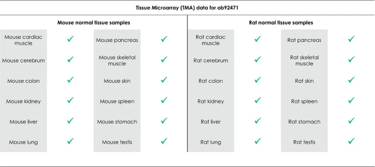 Immunohistochemistry (Formalin/PFA-fixed paraffin-embedded sections) - Anti-MSH6 antibody [EPR3945] - BSA and Azide free (AB214454)