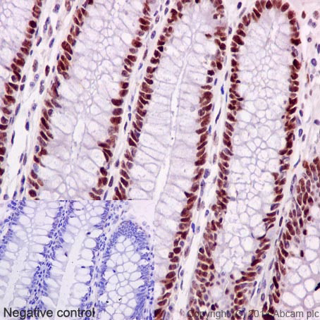 Immunohistochemistry (Formalin/PFA-fixed paraffin-embedded sections) - Anti-MSH6 antibody [EPR3945] - BSA and Azide free (AB214454), expandable thumbnail