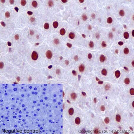 Immunohistochemistry (Formalin/PFA-fixed paraffin-embedded sections) - Anti-MSH6 antibody [EPR3945] - BSA and Azide free (ab214454), expandable thumbnail