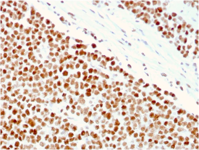 Immunohistochemistry (Formalin/PFA-fixed paraffin-embedded sections) - Anti-MSH6 antibody [MSH6/3086] - BSA and Azide free (AB259431)