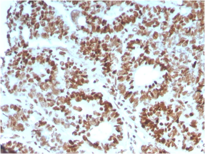 Immunohistochemistry (Formalin/PFA-fixed paraffin-embedded sections) - Anti-MSH6 antibody [MSH6/3086] - BSA and Azide free (AB259431)
