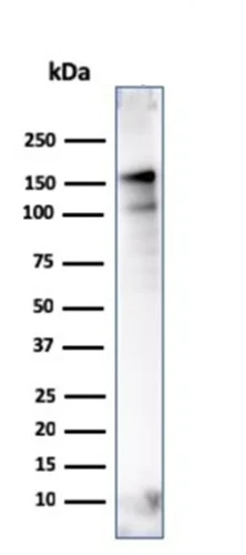 Western blot - Anti-MSH6 antibody [MSH6/3086] - BSA and Azide free (AB259431)