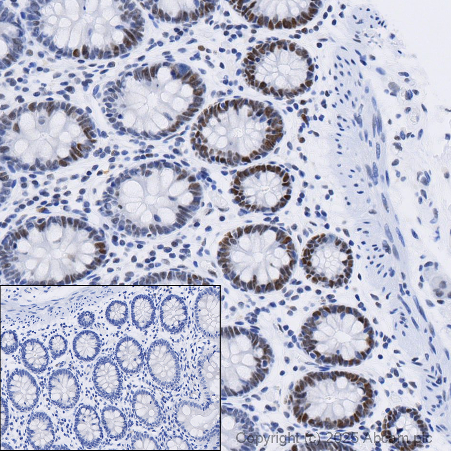 Abcam Anti-MSH6 antibody [SP93]
