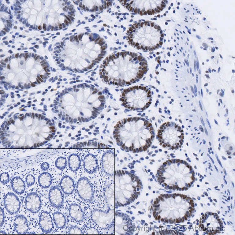 Immunohistochemistry (Formalin/PFA-fixed paraffin-embedded sections) - Anti-MSH6 antibody [SP93] (AB99889)