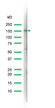 Western blot - Anti-MSH6 antibody [SP93] (AB99889)