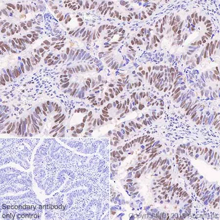 Immunohistochemistry (Formalin/PFA-fixed paraffin-embedded sections) - Anti-MSH6 antibody [SP93] - BSA and Azide free (AB238805)