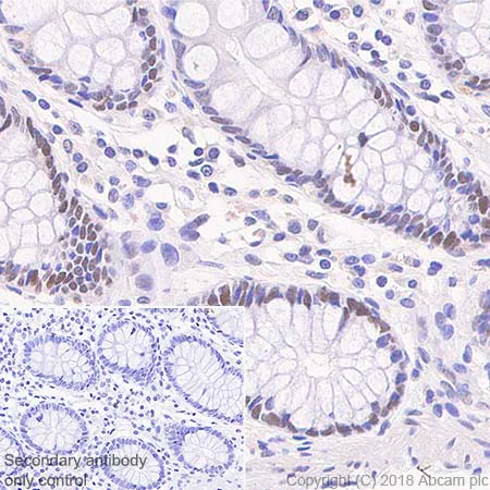 Immunohistochemistry (Formalin/PFA-fixed paraffin-embedded sections) - Anti-MSH6 antibody [SP93] - BSA and Azide free (AB238805)